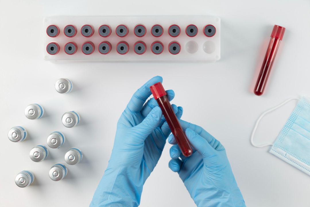 Urine Cotinine Test Cost Accuracy Detection Time Why Choose Diagnopein